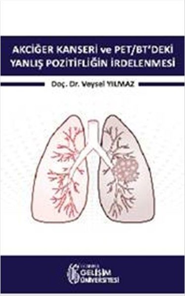 Akciğer Kanseri ve PET-BT`deki Yanlış Pozitifliğin İrdelenmesi