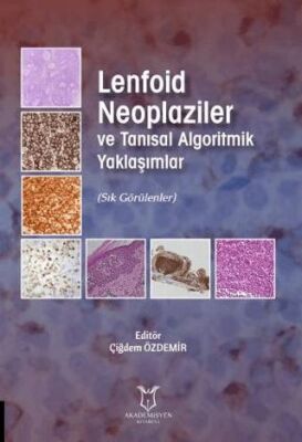 Lenfoid Neoplaziler ve Tanısal Algoritmik Yaklaşımlar kapağı