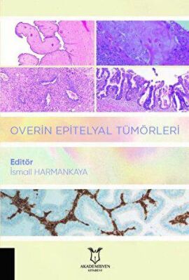 Overin Epitelyal Tümörleri kapağı