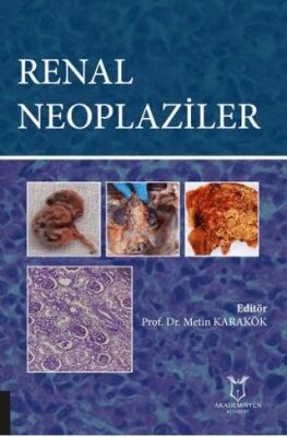Renal Neoplaziler kapağı