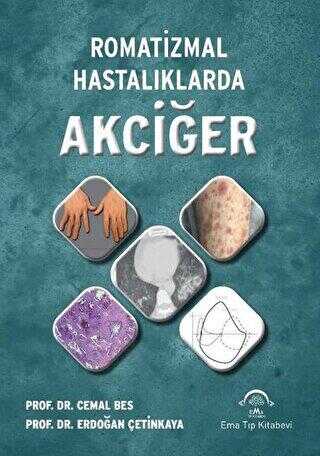 Romatizmal Hastalıklarda Akciğer kapağı