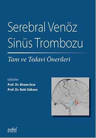 Serebral Venöz Sinüs Trombozu